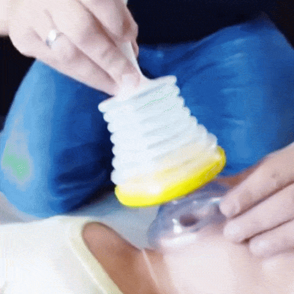 Anti-Choking Device Kit - 🎉 50% OFF TODAY – Skaldo & Malin