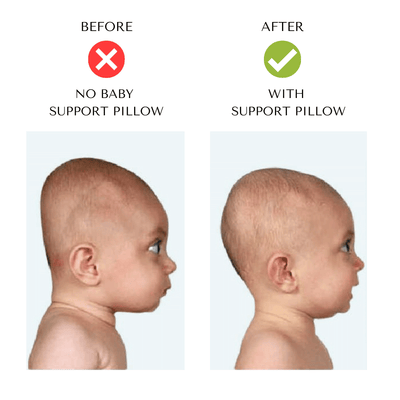Lucia Baby Sleep Support Pillow - 🎉 Buy 1 Get 1 Free - Skaldo & Malin